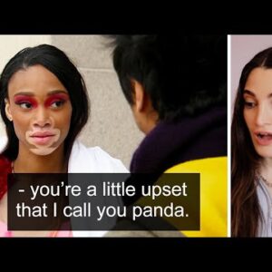 Yu Tsai Calls Model With Skin Condition "PANDA" on ANTM